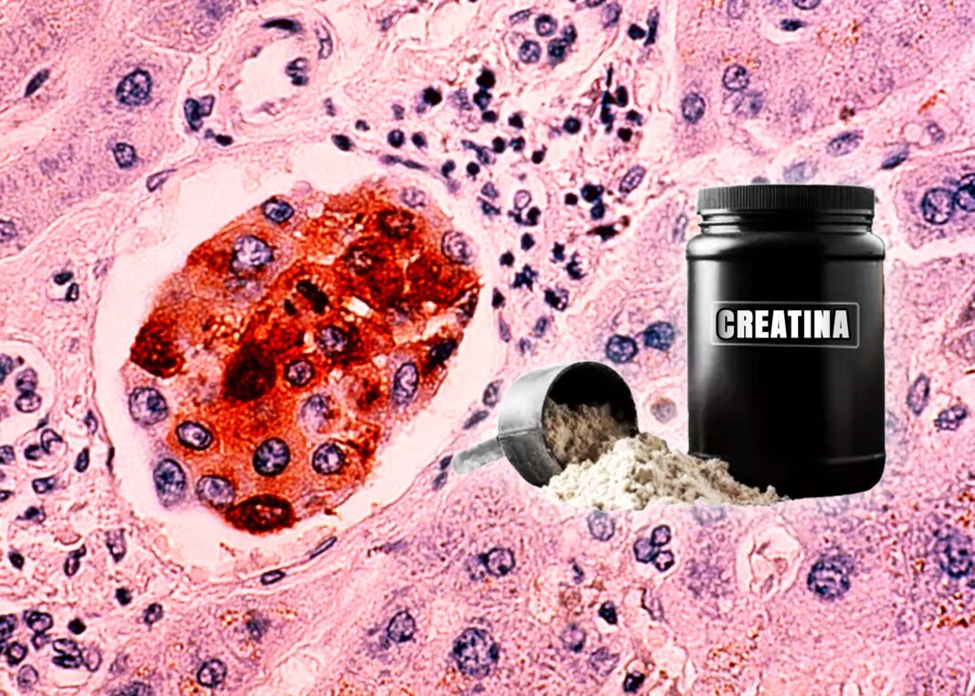 Científicos de UCLA descubren que la creatina fortalece el sistema inmune contra el cáncer Científicos de UCLA descubren que la creatina fortalece el sistema inmune contra el cáncer