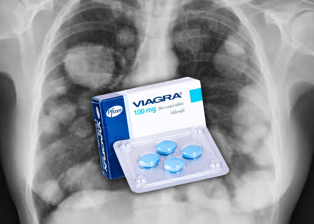 La VIAGRA, el tratamiento de ladisfunciĂłn erĂ©ctil podrĂa servirpara frenar el cáncer segĂşnnuevo hallazgo cientĂfico La VIAGRA, el tratamiento de ladisfunciĂłn erĂ©ctil podrĂa servirpara frenar el cáncer segĂşnnuevo hallazgo cientĂfico